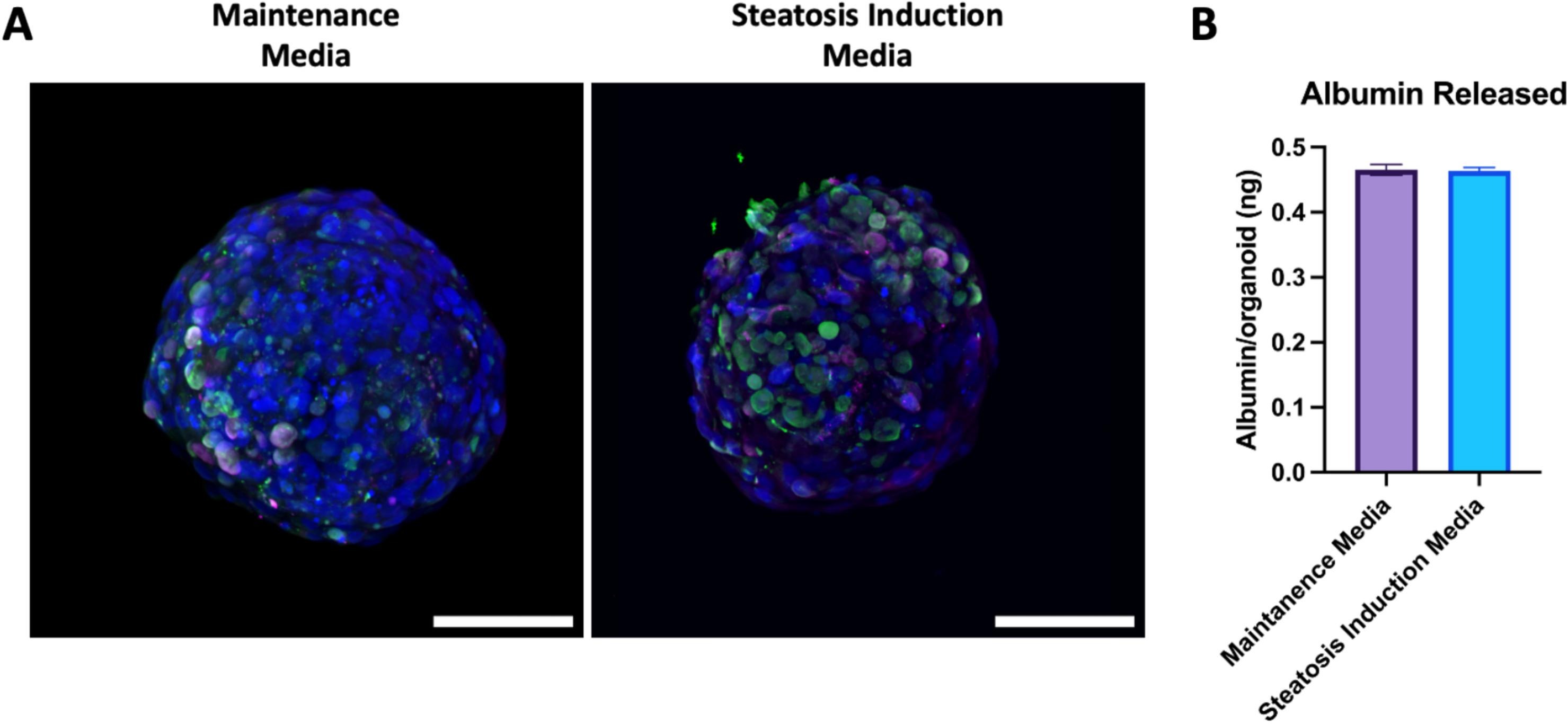 Engineering a three-dimensional liver steatosis model